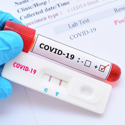 Es poden comunicar els positius de COVID-19 amb test d’antígens a sis farmàcies de Ripollet.